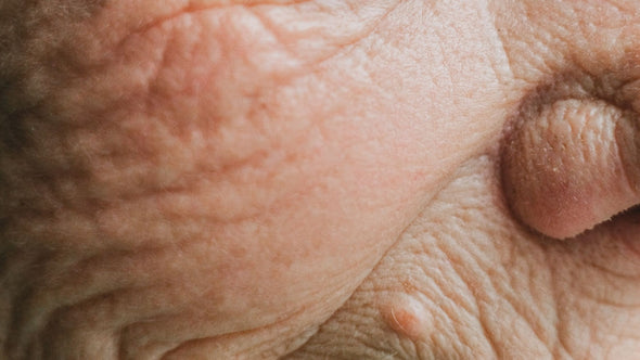 Aging, Glycation, Ages