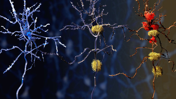 Aging Breakthroughs: Could Alzheimer’s Be Linked to the Gut?