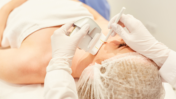 Radiofrequency Skin Tightening: Can Radiofrequency Treatment Replace a Facelift?