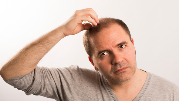 8 Myths About Hair Loss in Men