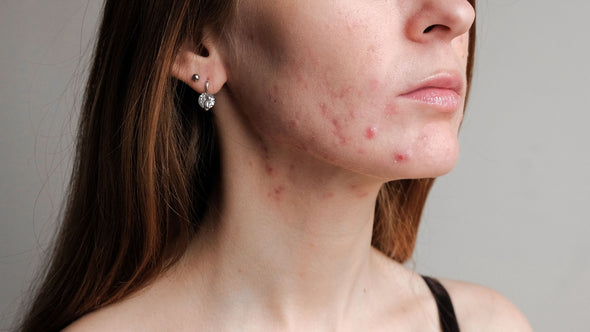 Skin Care for Everlasting Beauty