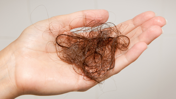 Different types of hair loss