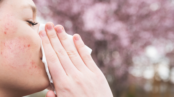 The Surprising Connection Between Seasonal Allergies and Your Skin