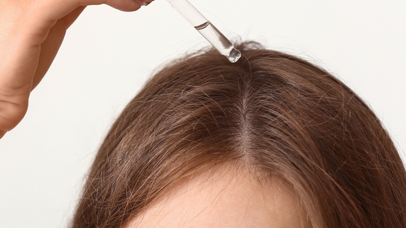 What is Minoxidil for Hair Loss?
