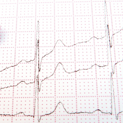 What Heart Rate Variability (HRV) Means for Our Health and Longevity