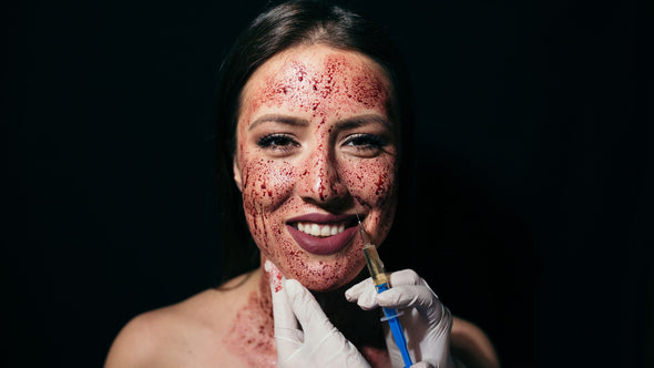 What’s a Vampire Facial?