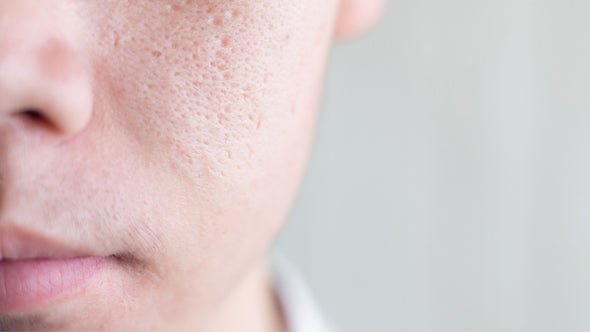Mythbusters: Do Pores Open and Close?