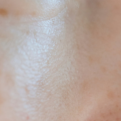 What are the Best Solutions for Oily Skin Care?