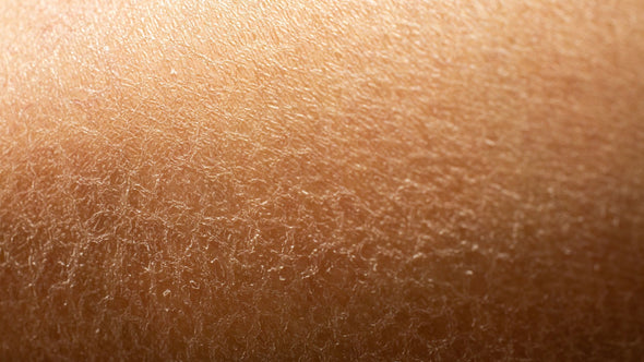 How to Avoid Sensitive Skin Problems